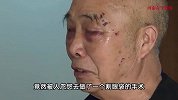 大爷遛弯被人拉去割眼袋秒变“熊猫眼”，诊所：不清楚顾客咋来的