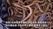 2女子入境抖落出一身鲜活黄鳝，绑藏身上共2.12千克，步态异常被查