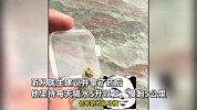 26岁程序员小伙腰酸剧痛，每天喝五升水，历时三个月后终于把9毫米肾结石尿出
