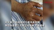 女子放羊时躺下休息被蛇咬，当场疼哭拍视频吐槽