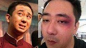 奇闻逸事说-20181102-被老婆家暴的男星们