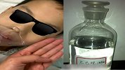 9岁男孩喝“矿泉水”后尿液变酱油色，医生一句话让家长毛骨悚然