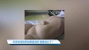 【辣妈萌宝】你家宝宝肚脐如果是这样 就要当心了！