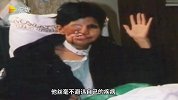 真“没脸见人”！ 女子右半边脸完全凹陷进去，但其并不避讳自己的长相！