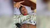 易建联完成手术后首度露面 回答友人问题摆剪刀手说：很NB啊