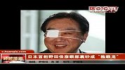 日本首相野田佳彦眼部裹纱成“独眼龙”