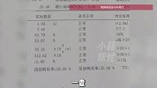 男子称结扎手术后媳妇又怀孕，医院回应：我们认，不逃避