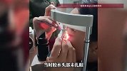 女子误将502喷入眼中，医生拔掉全部睫毛：感觉在剪我的肉