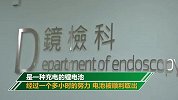 足足有14天！19岁女孩误吞电池 医生：幸亏还在胃里