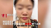 女子擤鼻涕掉出鼻息肉住院，狂冒血从嘴巴流入喉咙，医生：实属罕见