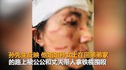 女子带200万嫁妆嫁人 被老公和公公当街暴打毁容