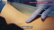20岁大学生被虫咬了一口，几周后竟要开胸换瓣膜，医生提醒