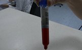 广东一女子踩50分钟动感单车 第二天小便呈酱油色
