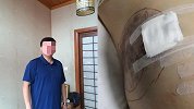 大连男子为减肥接受缩胃术后死亡 手术全国直播且“很成功”