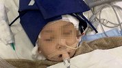 抚州“3死1伤”嫌犯在逃 第一起案件受伤男孩仍处高危期