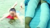 浙江一培训班上实验课6名孩子被烧伤 1人仍在ICU抢救