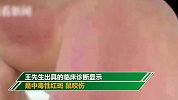 男子自称睡觉时被老鼠咬醒 酒店：有计划地讹诈