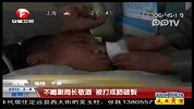 不喝副局长敬酒 被打成肺破裂