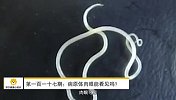 苏宁健康小知识第117期：病原体肉眼能看见吗？
