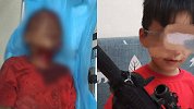 成都8岁男童电梯内被17岁男子毒打浑身是血 嫌疑人已被刑拘