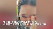 女子被大妈忽悠，眼睛挑出大量“虫子”被收2百，警方曾揭秘骗局