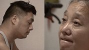 31岁小伙疑因吃隔夜菜致失明瘫痪：能活着真好