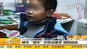 硬币爆炸灼伤幼童手原因成谜
