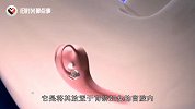 女性绝育是怎么“上环”的？3D动画演示全过程，看完心疼女人