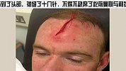 英超-1314赛季-鲁尼头部重伤 怒斥网友诈伤指责-新闻