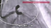 33岁男子突发心梗住进ICU，“心脏像烂了个洞”，妻子已怀孕6个月，医生紧急提醒