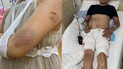 嫌3岁娃玩球噪音大！楼下闯楼上打全家 受害人自卫反被拘10天