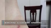 女子过敏去输液又被蜈蚣咬到，医生：输的液正好能解蜈蚣毒