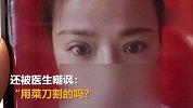 花9200元做的双眼皮，被人嘲讽为用菜刀割的吗？