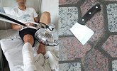 恐怖！天降菜刀 南宁一男子的腿筋被砍断