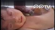 可怜婴儿心脏长体外