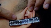 天津金色摇篮幼儿园针扎虐童案审判：5名幼师获刑