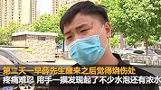 男子拔火罐忽然感觉眼角边有东西 睁眼后被恐怖一幕吓坏