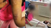 8岁女童遭亲爸后妈虐待多处烫伤 爷爷心痛报警 嫌疑人被刑拘