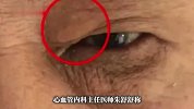 七旬老伯陪老伴住院，医生多看了他一眼竟发现猝死先兆