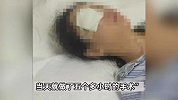 女子买大窑汽水放冰箱瓶体突然爆炸，右眼眼球被炸裂，厂家回应