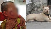 3岁男童惨遭狗咬致脸部缝30多针 狗主人至今未现身