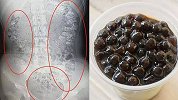 14岁女孩喝完珍珠奶茶挂急诊 照CT胃里发现百余颗“珍珠”