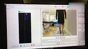 术后已能正常行走！赵继伟距离复出又进一步
