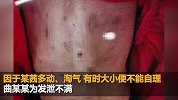 警方通报“4岁女童被虐打”：其父涉嫌故意伤害罪被拘