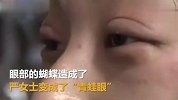 原生态大眼美女，拍完婚纱照变成青蛙眼！