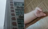 女子孕期超声检查正常后产下手指缺失婴儿 医院：愿给予一定赔偿