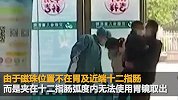 合肥2岁幼儿误吞21颗强吸力磁珠 开腹手术2小时才取出