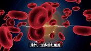 “红光满面”显年轻？别得意，“红得发紫”可能暗藏血液病危机了
