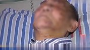 92岁老人遭养老院89岁室友殴打 面部缝了30多针
