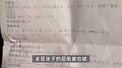 云南一男童小区内被狗咬伤，狗主人拒赔称是讹诈？家长：我让赔3500元，会继续维权